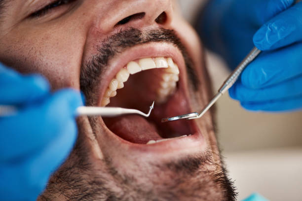 Best Cracked Tooth Emergency Dentist  in Woodville, OH
