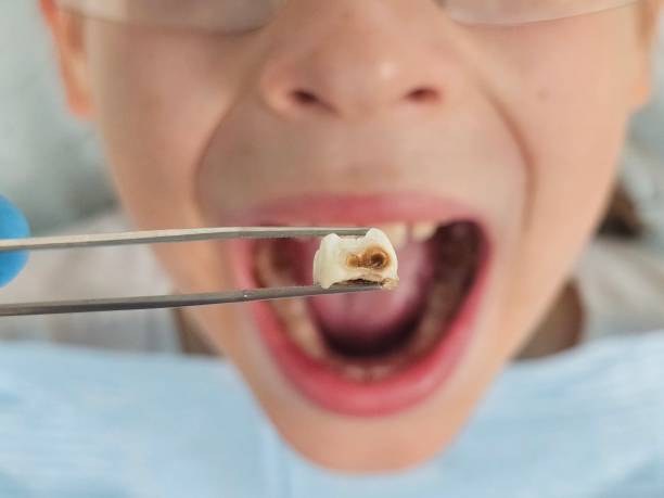 Best Teeth Whitening  in Woodville, OH