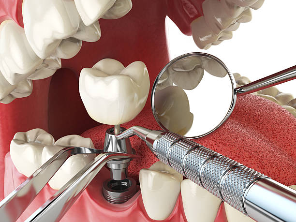 Best Knocked-Out Tooth Emergency  in Woodville, OH