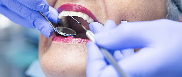 Best Root Canal Emergency Dentist  in Woodville, OH